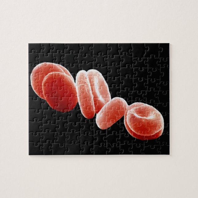 Puzzle Globules rouges (Horizontal)