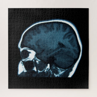Puzzle IRM du cerveau aux rayons X