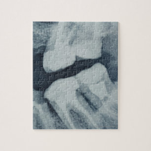 Puzzle Plan rapproché d'un rayon X dentaire