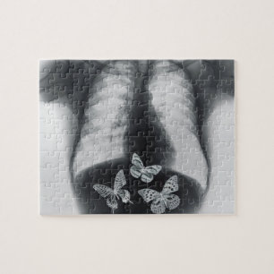 Puzzle Rayon X des papillons dans l'estomac