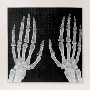 Puzzle Skeleton Hands Xray Photo Anatomie humaine photo