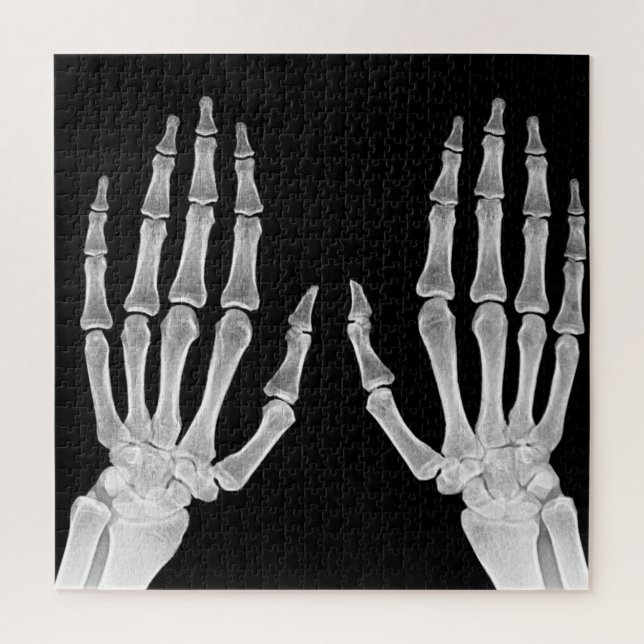 Puzzle Skeleton Hands Xray Photo Anatomie humaine photo (Vertical)