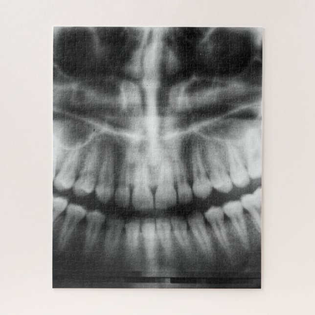 Puzzle X-Ray Teeth Bouche sourire noir et blanc (Vertical)