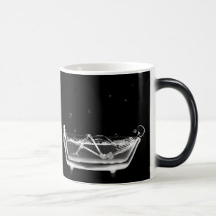 Radiographiez les tasses squelettiques de