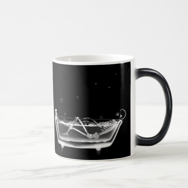 Radiographiez les tasses squelettiques de (Droite)