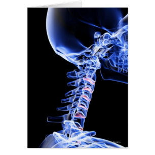 Radiographiez l'image des os du cou