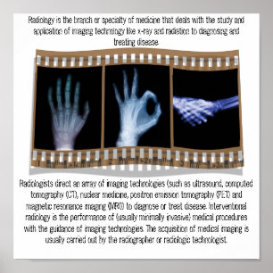 RADIOLOGIE - AFFICHE DE RAYON X - MAIN, OK,