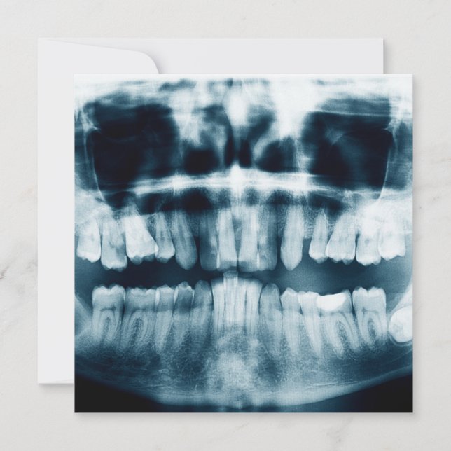 Rayon X des dents (Devant)