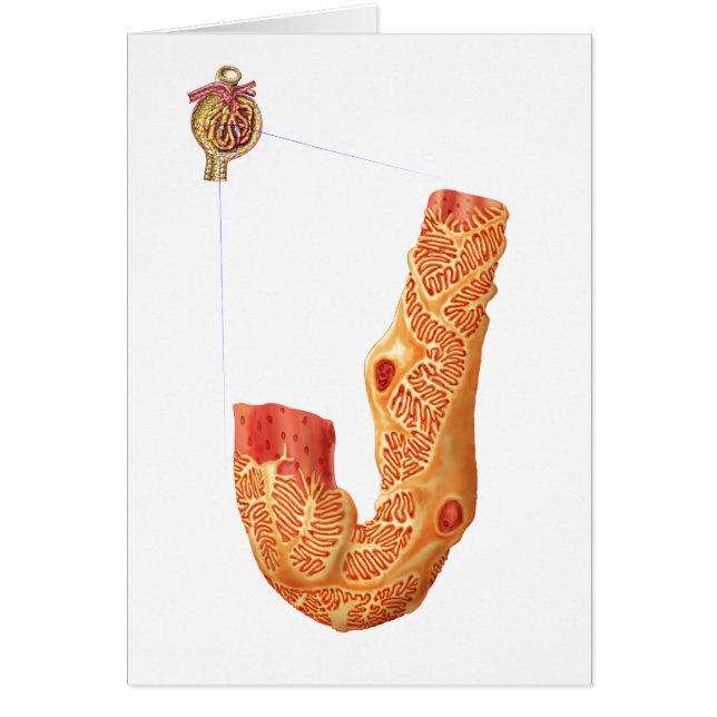 Renal Corpuscle Et L'Membrane De Filtration (Devant)