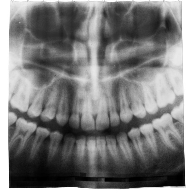 Rideaux De Douche X-Ray Teeth Bouche sourire noir et blanc (Devant)