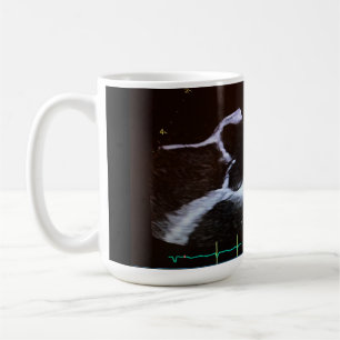 Robinet aortique doppler echocardiogramme tasse