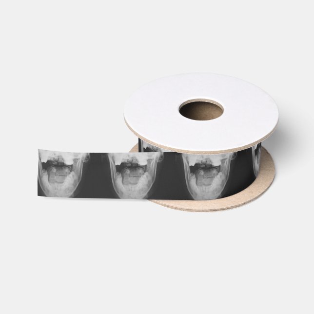 Ruban En Satin X-Rayed 3 (Original) (Bobine)