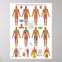 Sclérotome Douleur articulaire Poster Chiropratiqu