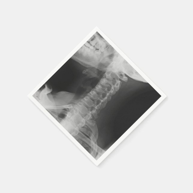 Serviette En Papier X-Rayed 2 (Original) (Coin)