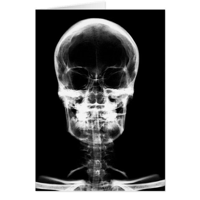 SKELETON VISION X-RAY SKULL - B&W (Devant)