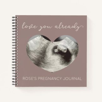 Sonogramme cardiaque simple Journal de grossesse
