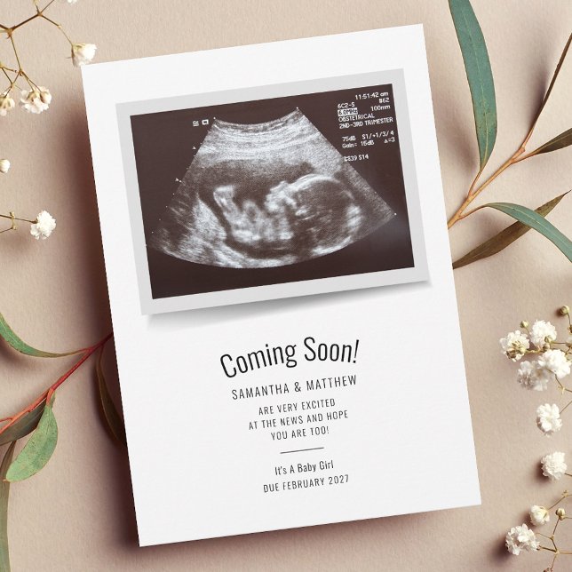Sonogramme de balayage de grossesse Faire-part béb (Pregnancy Announcement Sonogram Scan Card)