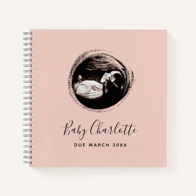 Sonogramme de fille rose Ultrasound Livre de gross (Devant)