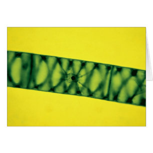 Spirogyra Algues vertes