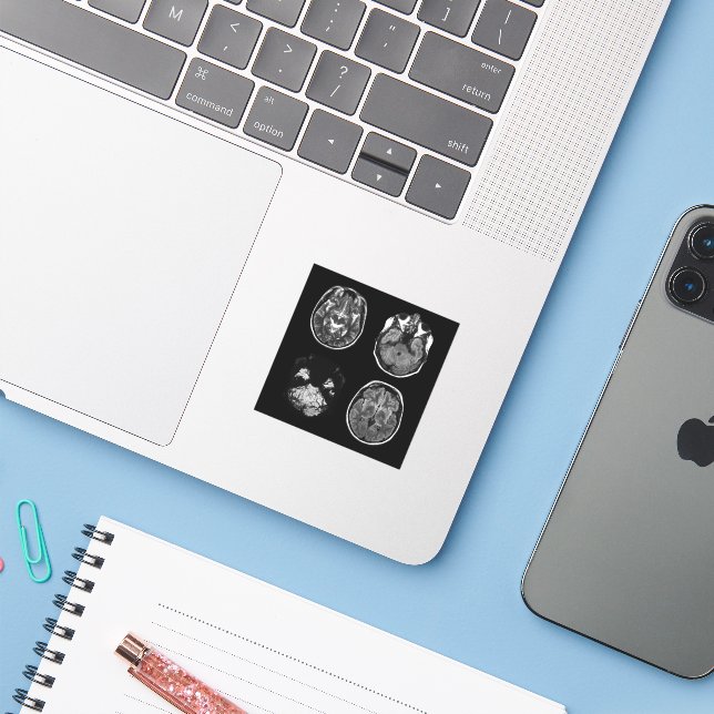 Sticker Analyse IRM du cerveau (Ordinateur portable avec iPhone)