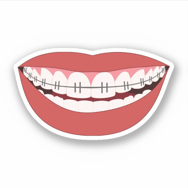 Sticker Appliance orthodontique Smile (Devant)