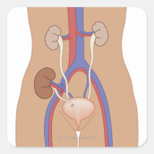 Sticker Carré Greffe de rein