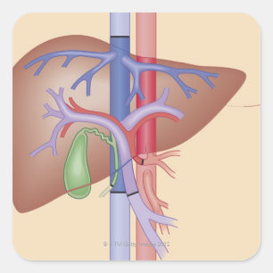 Sticker Carré Procédure de transplantation du foie
