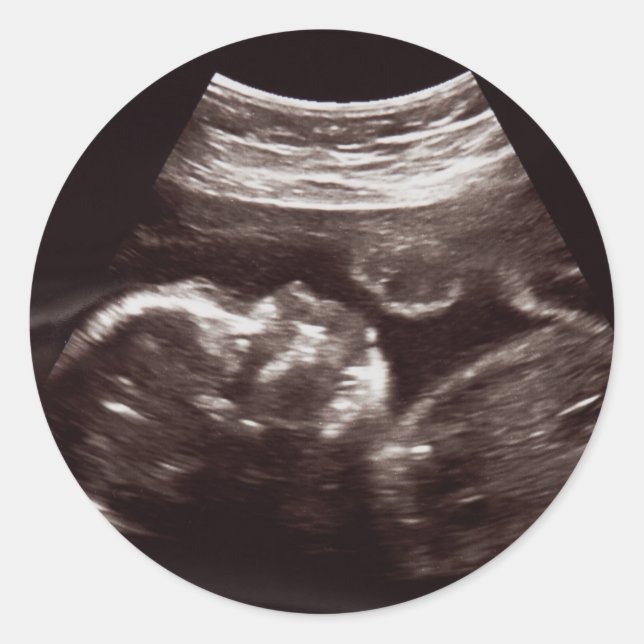 Sticker Rond Baby shower photo Ultrasound Merci (Devant)