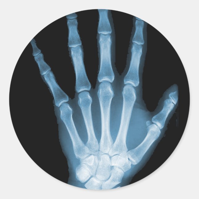 Sticker Rond Bleu X-ray Squelette main (Devant)