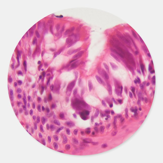 Sticker Rond épithélium cilié sous le microscope. (Devant)
