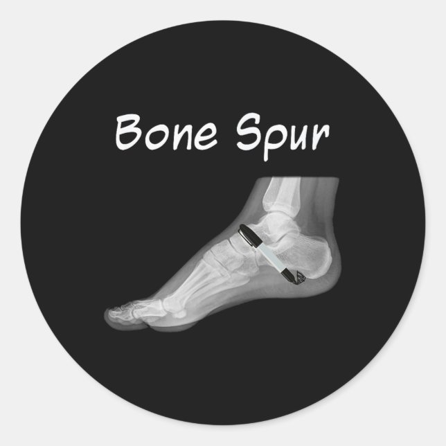 Sticker Rond Trump Bone Spur Enk Pen Drôle Anti Trump (Devant)