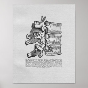 Subluxe Vertébrale Chiropratique Impression Vintag