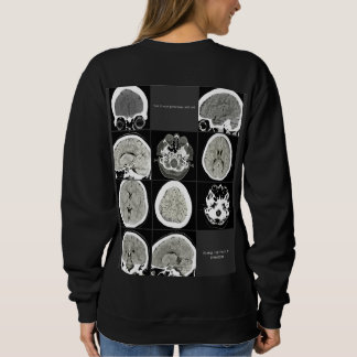 Sweatshirt Ce type de dépressionlookslike_FULLCTScan