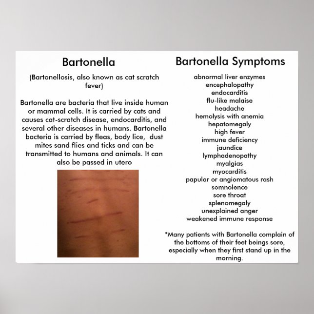 Symptômes Bartonella Poster éducatif (Devant)