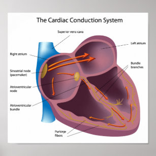 Système de conduction cardiaque Affiche
