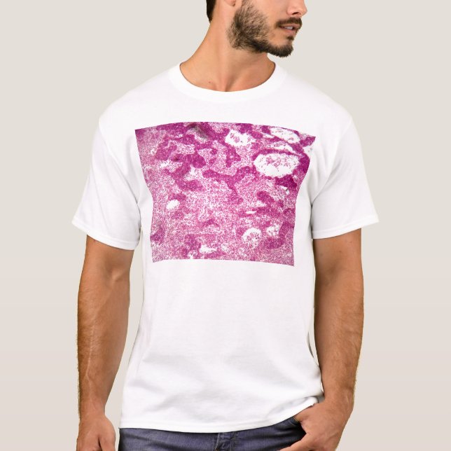 T-shirt Cellules de ganglion lymphatique sous le (Devant)