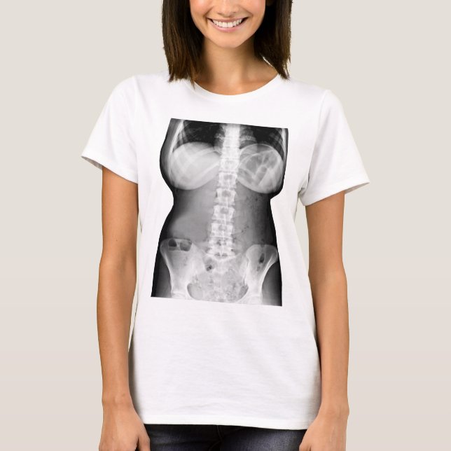 T-shirt Corps féminin Xray Skeleton Photo (Devant)