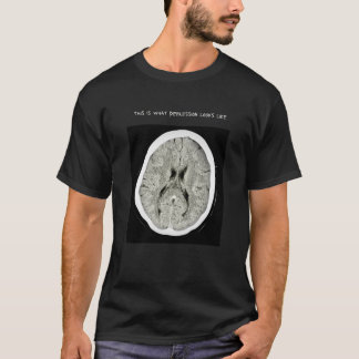 T-shirt CT Scan_ CTFOD_Voici à quoi ressemble la dépressio