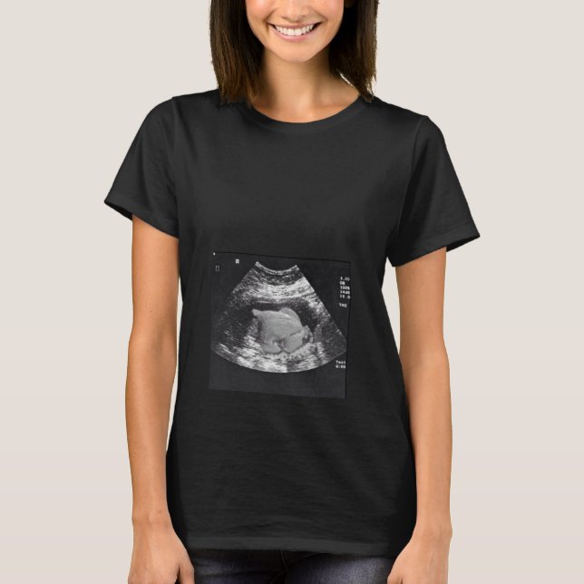 T-SHIRT ENCEINTE TURQUIE ULTRASOUND (Devant)