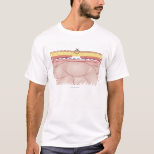 T-shirt Illustration d'une hernie