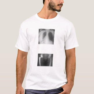 T-shirt Ma hanche juste fendue de la tristesse