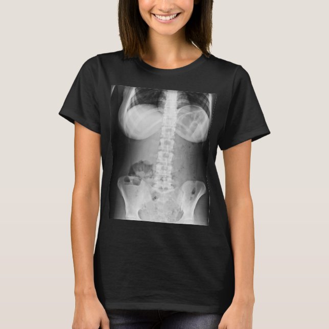 T-shirt Médicale Xray Photo anatomie du corps humain (Devant)