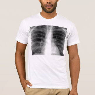 T-shirt Radiographie de la poitrine