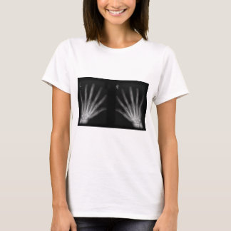 T-shirt Rayon X numérique supplémentaire, main droite et m