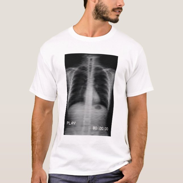 T-shirt “Retro VHS X-Ray” Old-school chest X-ray with VHS  (Devant)