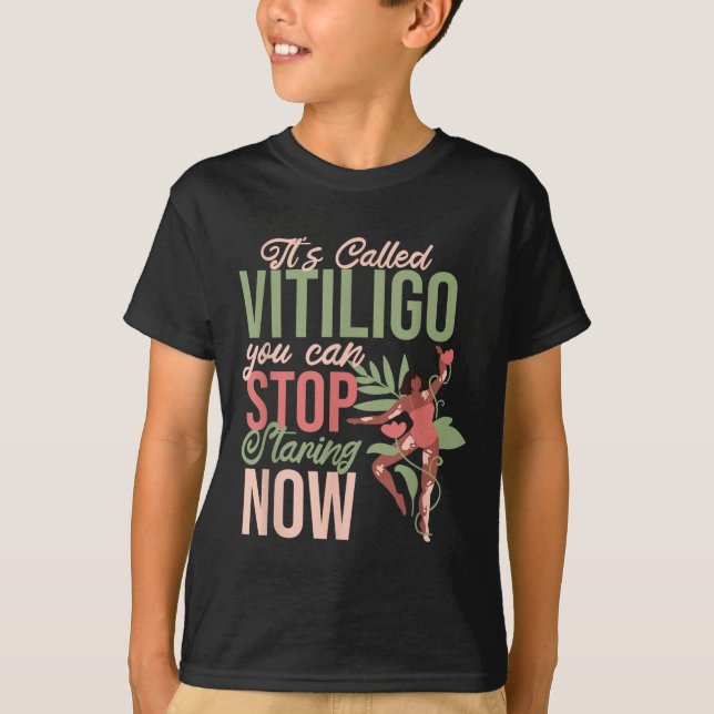 T-shirt Son Appelé Vitiligo Vous Pouvez Cesser De Staring, (Devant)