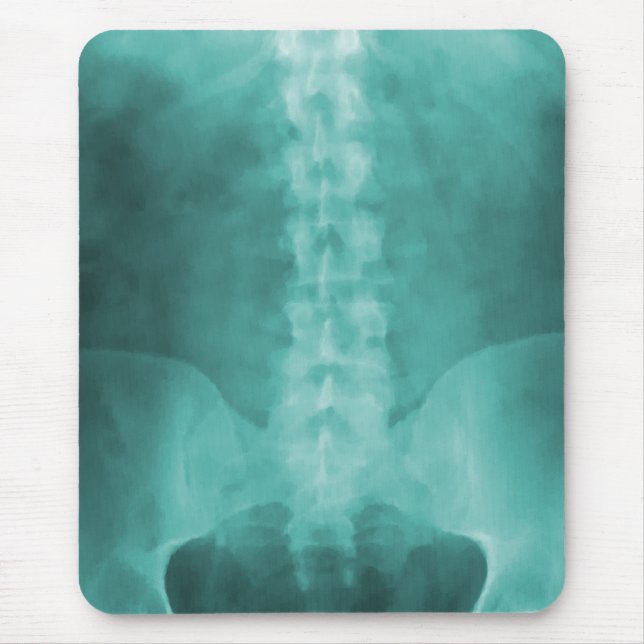 Tapis De Souris Art Mousepad de rayon X de Digitals d'Aqua (Devant)