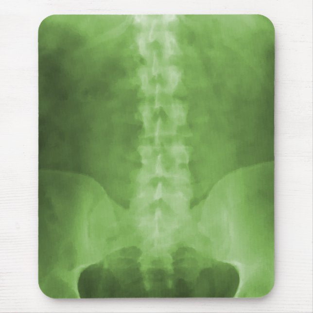 Tapis De Souris Art vert Mousepad de rayon X de Digitals (Devant)