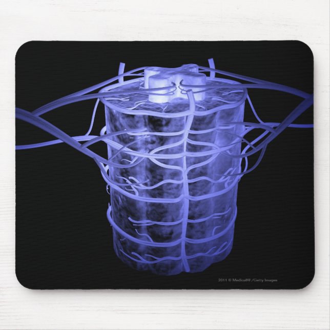 Tapis De Souris Artères entourant une partie de la colonne (Devant)