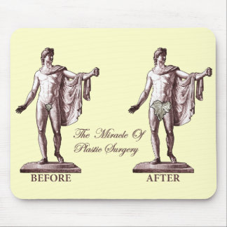 Tapis De Souris Avant et après